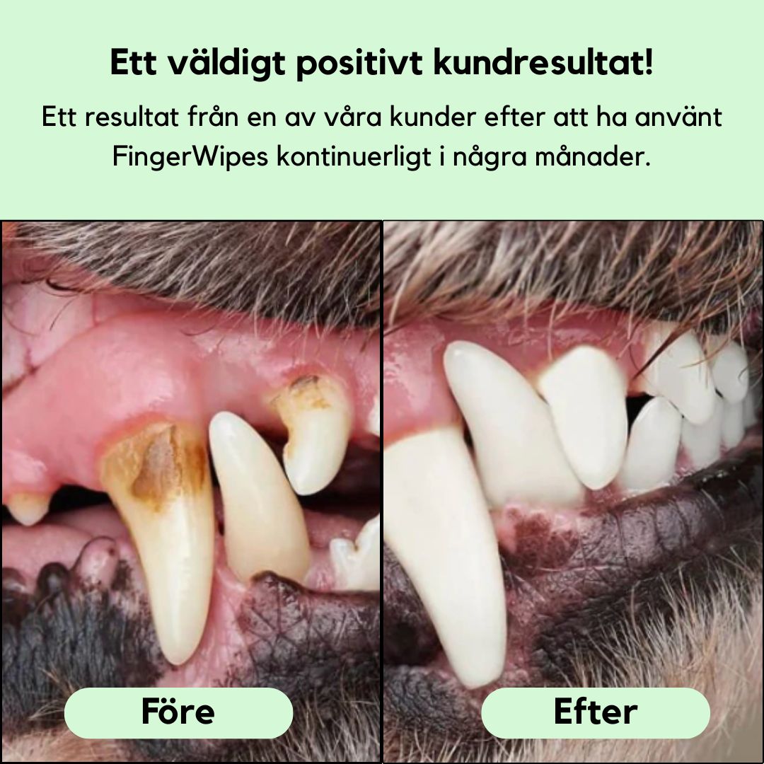 FreshWipe Kit - Skyddar mot tandproblem